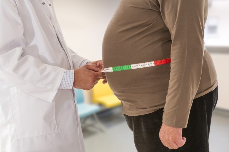 Deputados debatem realização de cirurgia bariátrica no SUS